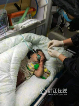 小女孩在醫(yī)院接受治療。