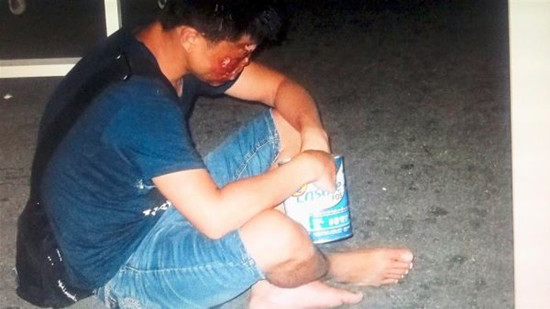 馬來西亞《星報》10月17日揭露跨國犯罪團(tuán)伙在中國拐騙兒童的消息稱，犯罪團(tuán)伙將拐來的兒童弄?dú)?、毀容并囚禁多年，再帶到馬來西亞各景點(diǎn)行乞。據(jù)報道，犯罪團(tuán)伙讓行乞者持旅游簽證入境馬來西亞，到各個旅游景點(diǎn)行乞，并將大部分“收入”上繳團(tuán)伙頭目。