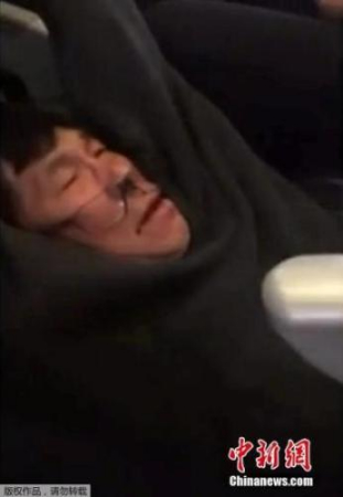 圖為遭受美聯(lián)航暴力驅(qū)趕的亞裔乘客。