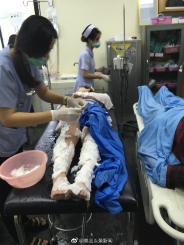 泰國(guó)皮皮島附近一快艇突發(fā)爆炸，多名中國(guó)人受傷(圖：泰國(guó)頭條新聞微博)