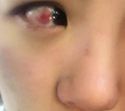 受害者供圖(新西蘭天維網(wǎng))