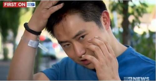 中國(guó)僑網(wǎng)陳基思展示受傷的頭部。(新西蘭天維網(wǎng)援引澳洲九號(hào)臺(tái)圖片)