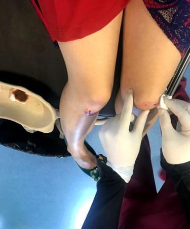 中國僑網(wǎng)希臘醫(yī)生幫助Maya處理傷口。(意大利歐聯(lián)網(wǎng))