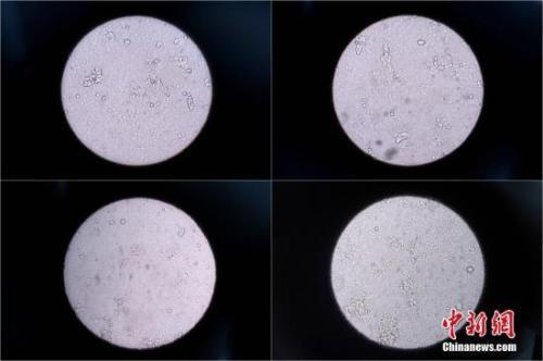 中國僑網(wǎng)資料圖:近期流感席卷全球。韋亮 攝