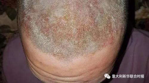 中國僑網(wǎng)(資料圖:意大利《新華聯(lián)合時報》微信公眾號)