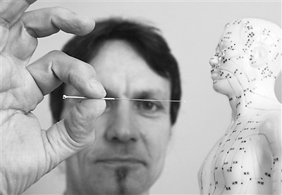 老外學(xué)針灸